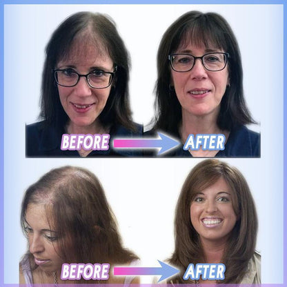 🔥LAST DAY 49% OFF🔥Magic Clip-on Hair Topper